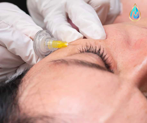 Carbociterapia + ultrasonido