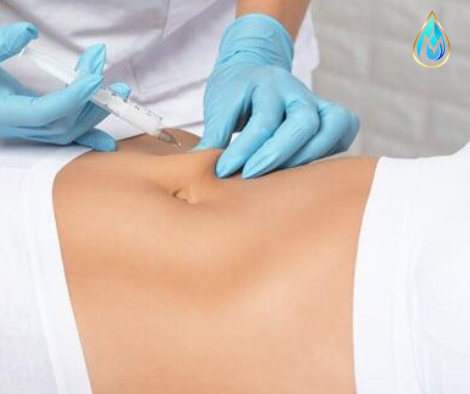 Procedimiento de Hidrolipo corporal en abdomen